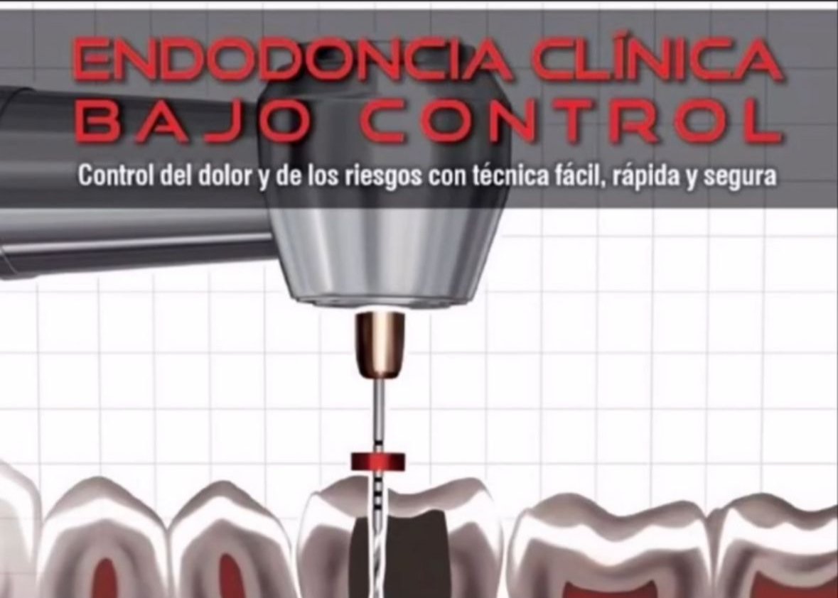 Capa do livro Endodoncia Clínica Bajo Control